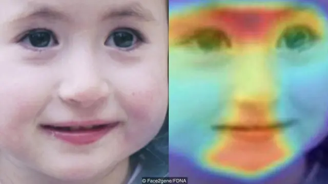 वर्चुअल डॉक्टर, आर्टिफ़िशियल इंटेलिजेंस