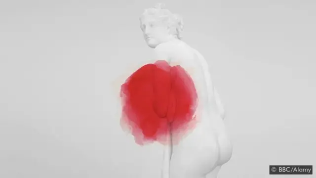 Les médecins ne trouvent parfois pas de preuves de lésions lors des premiers scanners