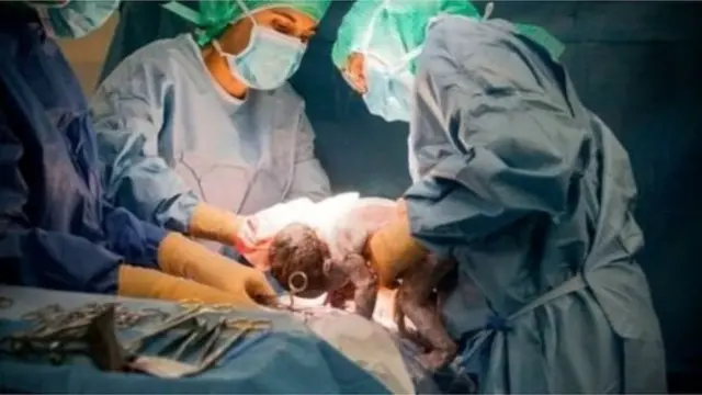 சித்தரிப்பு புகைப்படம்