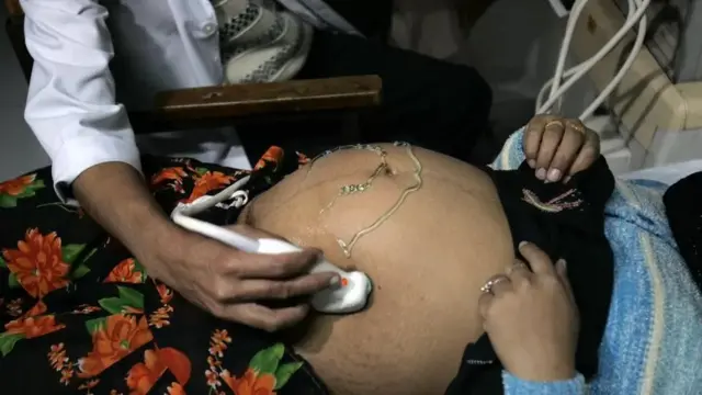 गर्भपात पर अमेरिकी सुप्रीम कोर्ट का फ़ैसला