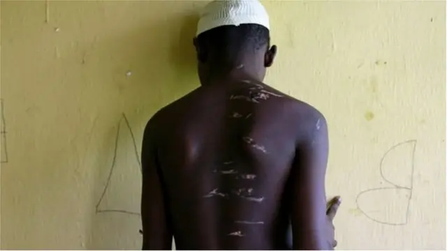 ১৫ বছর বয়সী এই কিশোর দেখাচ্ছেন কিভাবে তাকে প্রহার করা হয়েছে