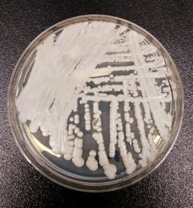 Cultivo de Candida auris