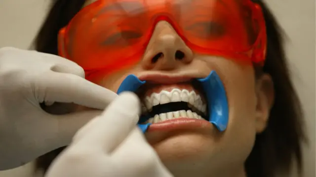 Professional teeth whitening treatments are often more powerful than those used at home