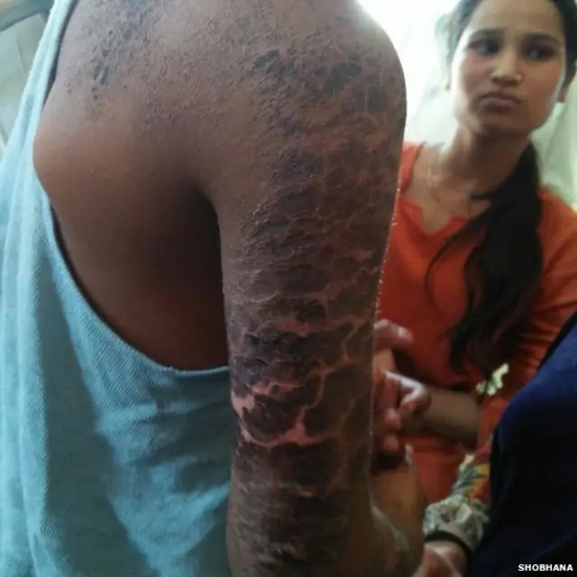 बच्चे, गोरापन, क्राइम