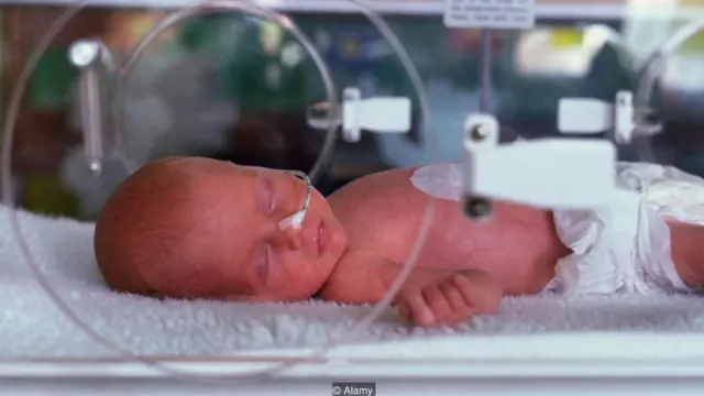 母乳喂养的早产儿发生肠道问题和严重感染如败血症的可能性较低。