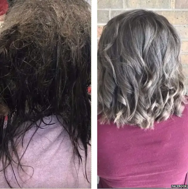 डिप्रेशन, मानसिक स्वास्थ्य, खूबसूरती