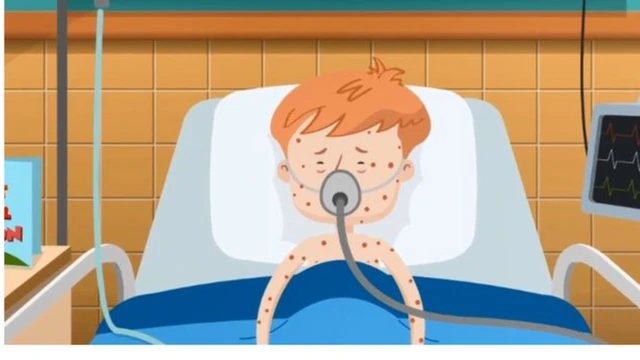 Aworan ọmọ to ni arun Ẹyi ti wọn n tọju lori ibusun