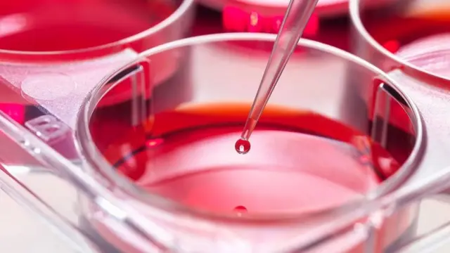 لا توجد أية قيود على استخدام الخط الخلوي WI-38