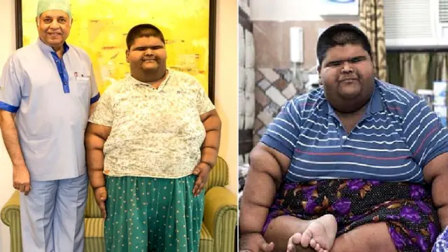 உடல் பருமன்