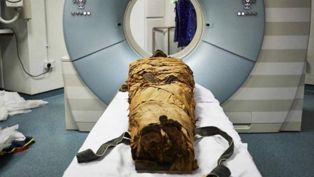 Múmianuméro de téléphone 1xbetNesyamun é submetida a tomografia computadorizada no Leeds General Infirmary