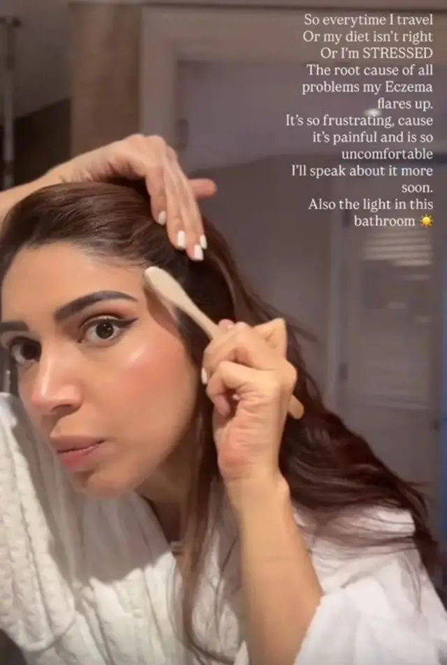 بھومی پڈنیکر نے لکھا کہ وہ جب بھی تناؤ میں ہوتی ہیں تو ان کا ایگزیما ابھر آتا ہے