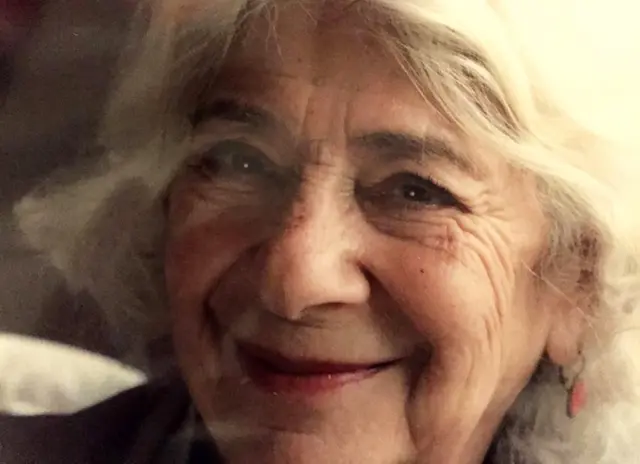 Dolly in later life