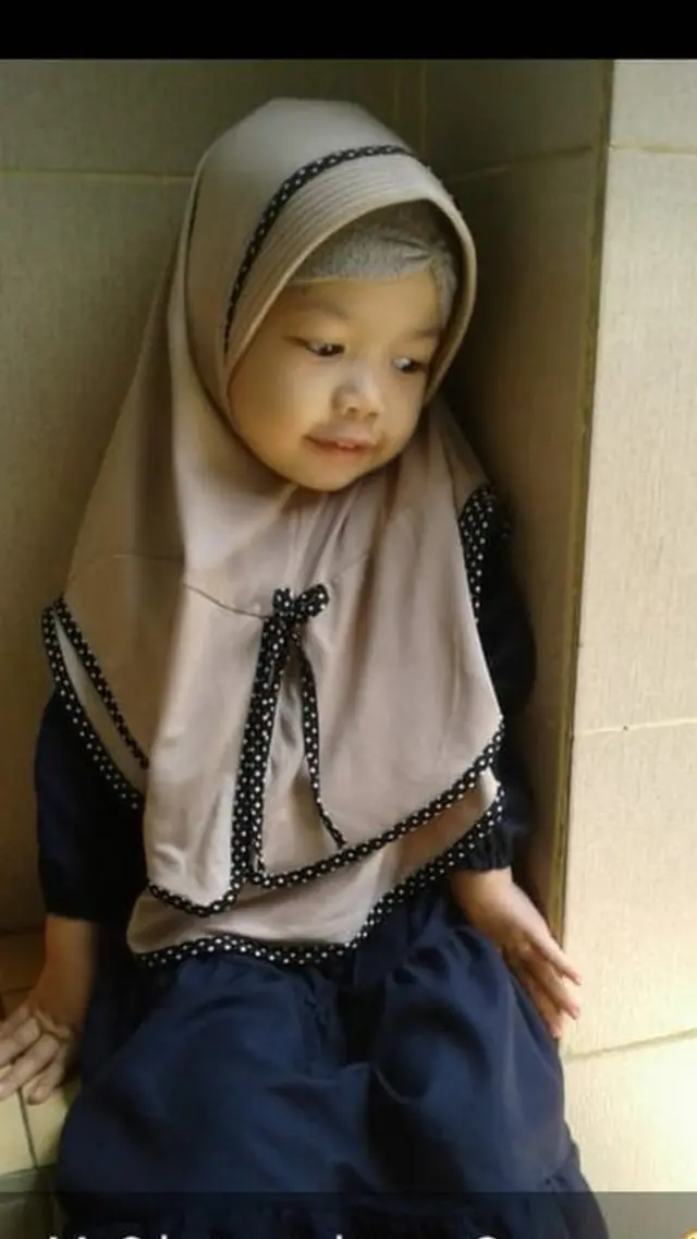 gagal ginjal akut obat sirop