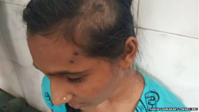 ਬਾਘ ਨਾਲ ਭਿੜੀ ਰੁਪਾਲੀ, ਫਿਰ ਲਈ ਸੈਲਫੀ