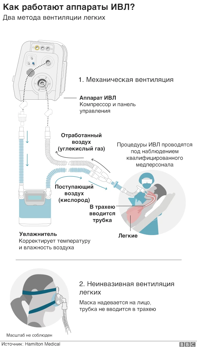 Аппараты ИВЛ для больных Covid-19 - что это такое и как они работают ...
