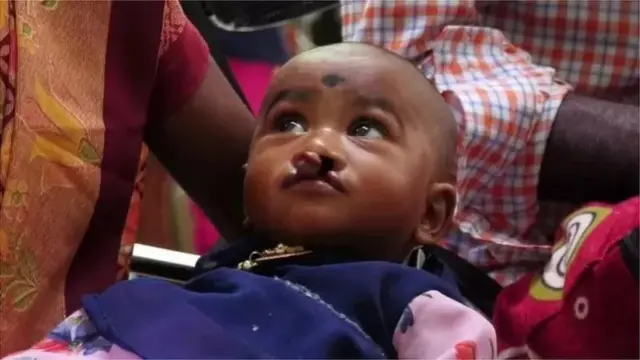 सूर्यग्रहण