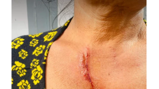 လုယက်ခံရသူ