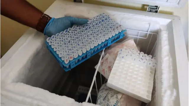 ఉద్దానం, కిడ్నీ సమస్యలు