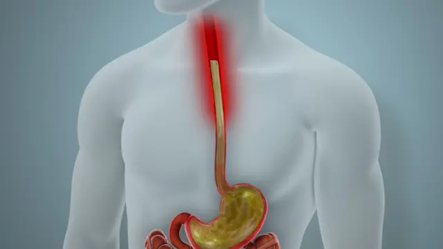 மலம், அல்சர், உணவுப்பழக்கம், கல்லீரல்