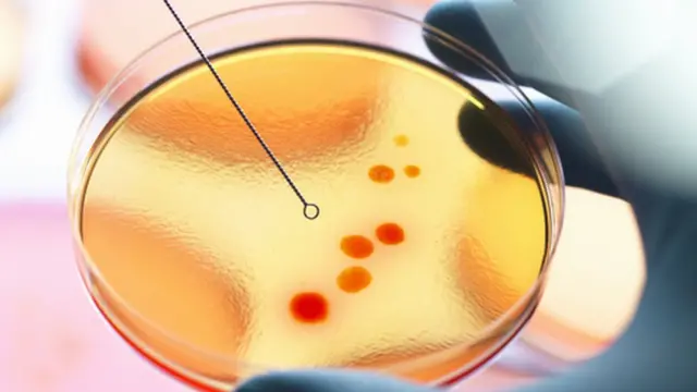 கொரோனா வைரஸ்