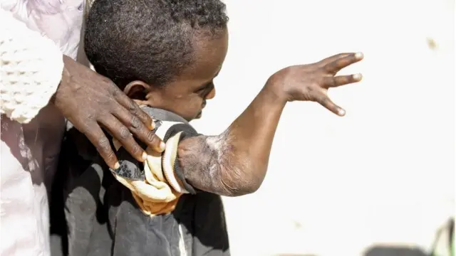 Kumannaan qof ayaa ku dhintay ama ku dhaawacmay colaadda gobolkaasi Tigray