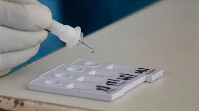 অ্যান্টিজেন টেস্ট কিট।