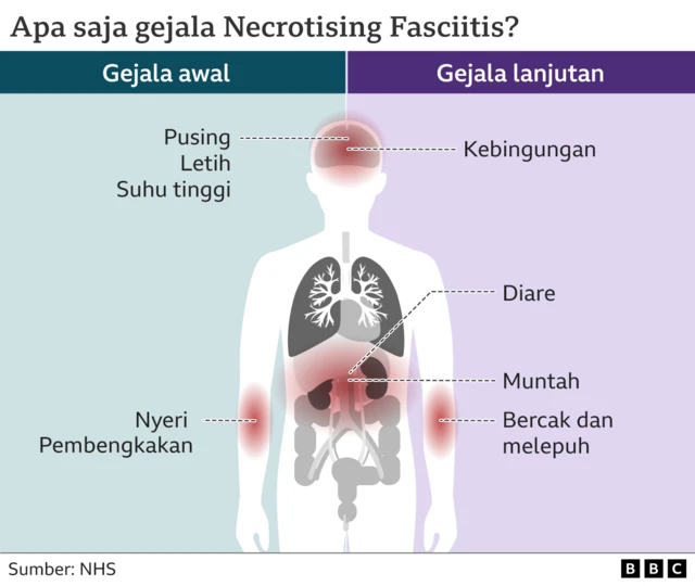 bakteri pemakan daging