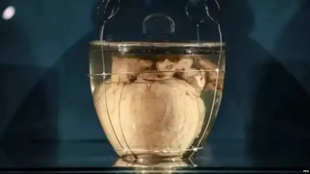 ਪੈਡ੍ਰੋ ਦਾ ਦਿਲ ਬ੍ਰਾਜ਼ੀਲ ਪਹੁੰਚਣਾ ਇੱਕ ਵੱਡੀ ਇਤਿਹਾਸਕ ਘਟਨਾ ਹੈ ਪਰ ਲੋਕ ਇਸ ਨਾਲ ਜੁੜਾਅ ਮਹਿਸੂਸ ਨਹੀਂ ਕਰਦੇ ਜਿੰਨਾ ਕਿ ਸਰਕਾਰਾਂ ਕਰਦੀਆਂ ਹਨ