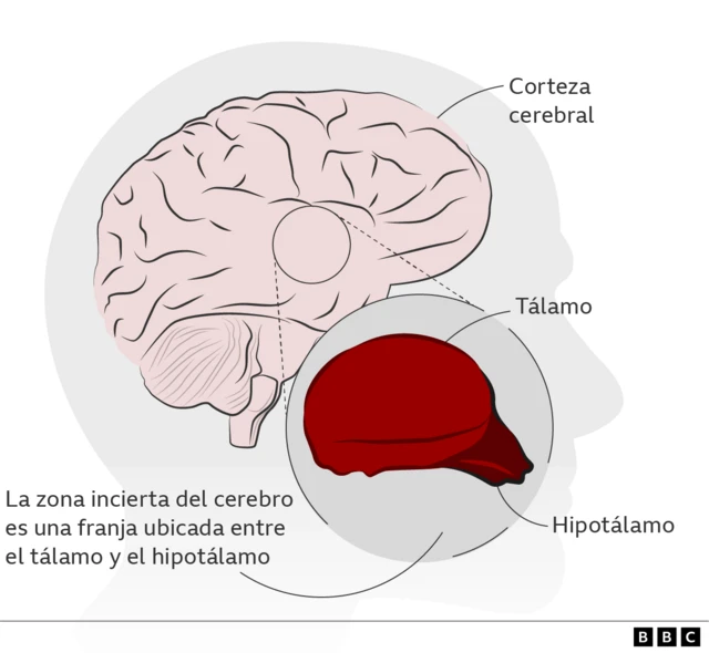 Cerebro