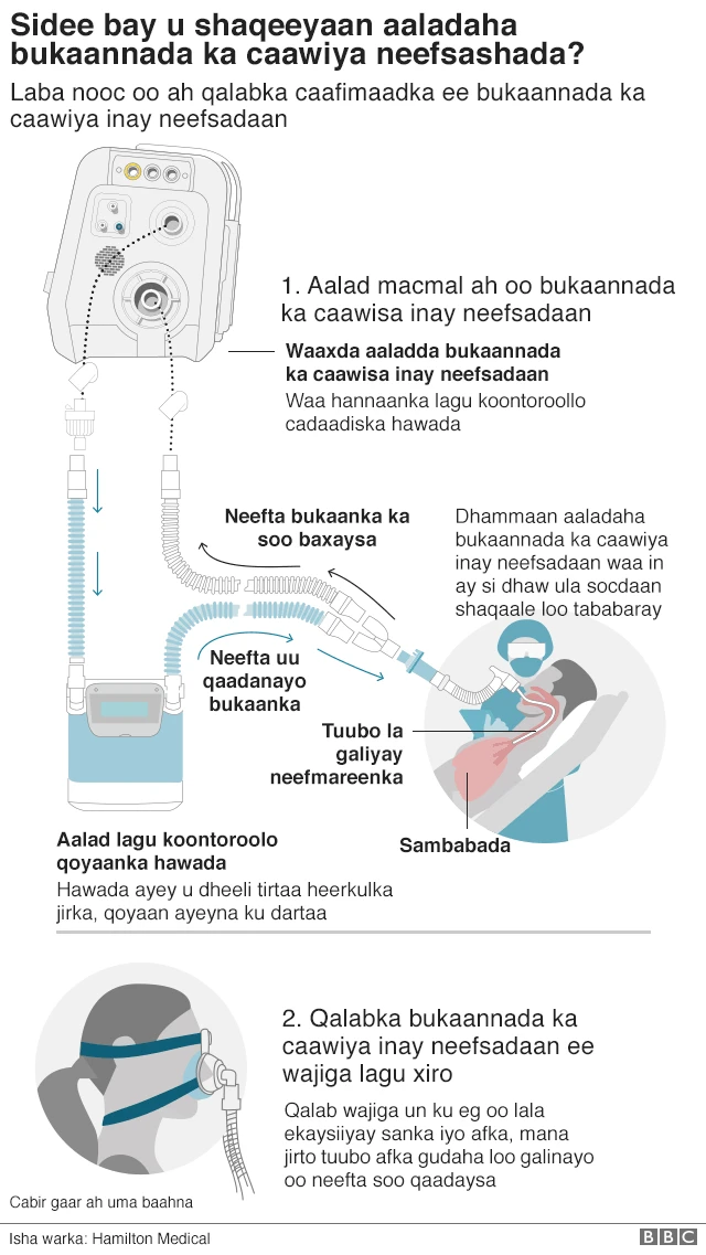 Qalabka neefta siiya dadka uu naqaska ku dhego ee qaba fayraska corona