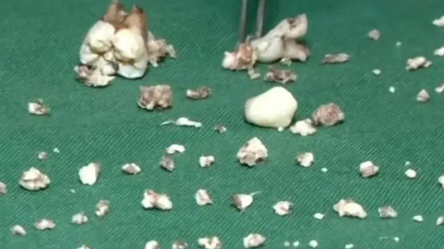 Ụfọdụ eze ndị a wepụtara n'ọnụ nwata ahụ