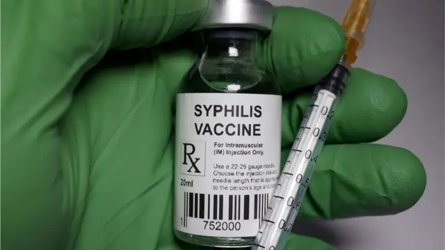 Sífilis.