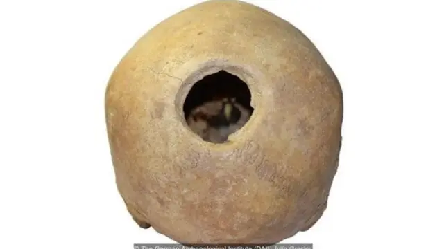 कवटी, शास्त्र, पुरातत्व