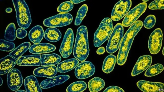 टीबी वैक्सीन, टीबी, tuberculosis vaccine