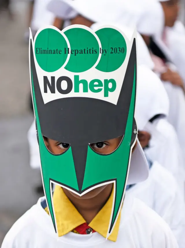 హెపటైటిస్