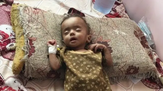 Yardım kuruluşları Yemen'de 7 milyon insanın açlık sınırında olduklarını söylüyor