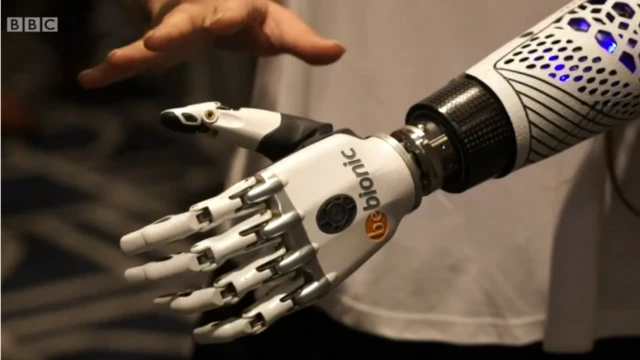 Este es el brazo de Angel Giuffria.