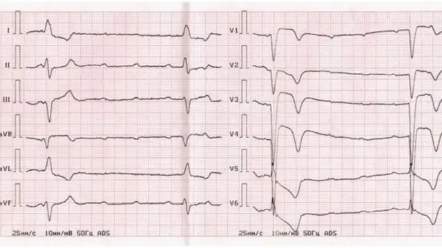 सांकेतिक तस्वीर