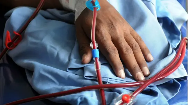 Patient on Dialysis