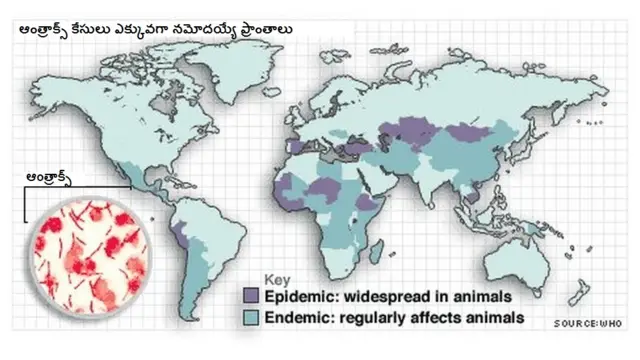 ఆంత్రాక్స్