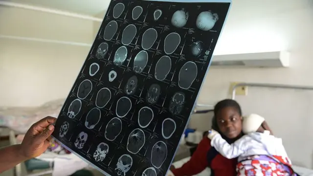 Eserese na-egosi nnyocha ụbụrụ