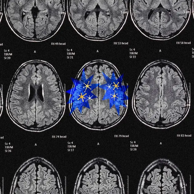 设计图片：一张电脑扫描胶卷片，上面以蓝色图形标记出大脑电波活动