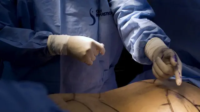 பேரியாட்ரிக் அறுவை சிகிச்சை