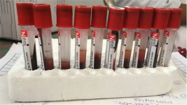 జికా వైరస్