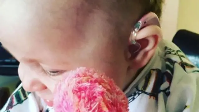 마틸다는 생후 3개월부터 보청기를 착용해야 했다