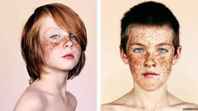 ફ્રેકલ્સ ધરાવતા લોકોની તસવીરો