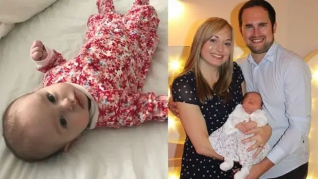 বিরল এক জেনেটিক ডিজ-অর্ডার নিয়ে জন্মেছিল সেরেন নামে শিশুটি