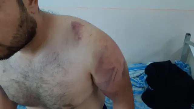 Мурожаатномага бир неча жароҳат суратлари илова қилинган