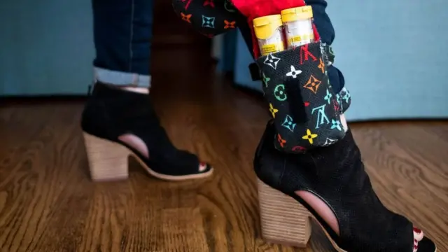 Харчова алергія