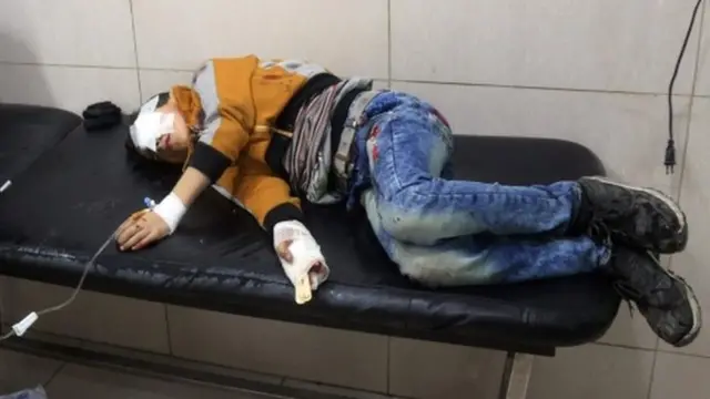 Sirio herido en un hospital